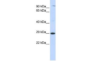 WB Suggested Anti-TSPAN2 Antibody Titration:  0. (Tetraspanin 2 anticorps  (Middle Region))