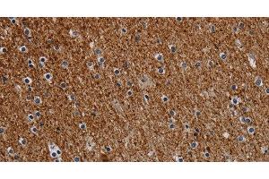 Immunohistochemistry of paraffin-embedded Human brain tissue using DCAF6 Polyclonal Antibody at dilution 1:30 (DCAF6 anticorps)