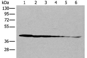 Western blot analysis of Rat brain tissue Human cerebrum tissue Human fetal brain tissue Hela cell Human breast cancer tissue Jurkat cell lysates using PITPNB Polyclonal Antibody at dilution of 1:500 (PITPNB anticorps)