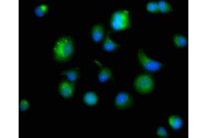 Immunofluorescence staining of MCF-7 cells with ABIN7164840 at 1:166, counter-stained with DAPI. (Prosaposin anticorps  (AA 311-391))