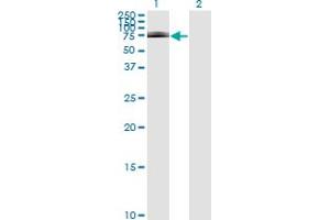 Western Blot analysis of IRAK1 expression in transfected 293T cell line by IRAK1 monoclonal antibody (M01), clone 3F7. (IRAK1 anticorps  (AA 530-693))