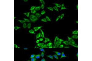 Immunofluorescence analysis of MCF-7 cells using CHMP2B Polyclonal Antibody (CHMP2B anticorps)