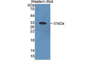 Western blot analysis of the recombinant protein. (Complement C4 anticorps  (AA 126-366))