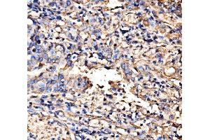 IHC analysis of HECTD1 using anti-HECTD1 antibody (ABIN7601584). (HECTD1 anticorps  (AA 39-566))