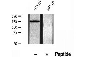 Western blot analysis of extracts of COLO 320 cells, using KIAA1199 antibody. (CEMIP anticorps  (C-Term))