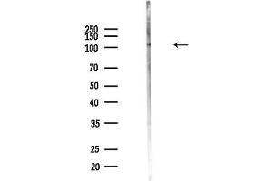 Western blot analysis of lysates from MCF7 cells, using Phospho-PKD1/PKC mu (Ser910) Antibody at 1/1000 dilution.
