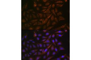 Immunofluorescence analysis of U-2 OS cells using V/V/Cellubrevin Rabbit mAb (ABIN7271314) at dilution of 1:100 (40x lens). (VAMP3 anticorps)