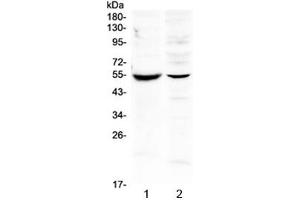 Western blot testing of 1) mouse intestine and 2) human SMMC-7721 lysate with MMP16 antibody at 0.
