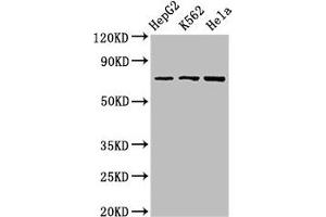 Western Blot Positive WB detected in: HepG2 whole cell lysate, K562 whole cell lysate, Hela whole cell lysate All lanes: DBF4 antibody at 2. (DBF4 anticorps  (AA 101-281))