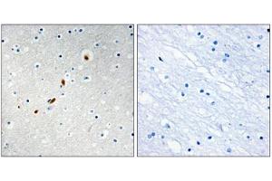 Immunohistochemistry analysis of paraffin-embedded human brain tissue using ZNF596 antibody. (ZNF596 anticorps  (Internal Region))