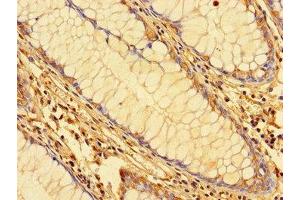 Immunohistochemistry of paraffin-embedded human colon tissue using ABIN7156118 at dilution of 1:100