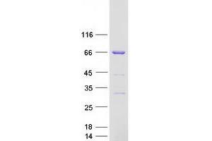 Validation with Western Blot