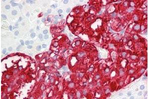 Anti-DBH antibody IHC staining of human adrenal.