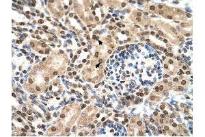 IFIT3 antibody was used for immunohistochemistry at a concentration of 4-8 ug/ml to stain EpitheliaI cells of renal tubule (arrows) in Human Kidney. (IFIT3 anticorps  (N-Term))