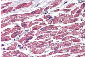 Human Heart (formalin-fixed, paraffin-embedded) stained with TSC1 antibody ABIN214539 at 2. (TSC1 anticorps)