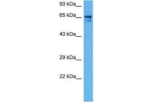 Host:  Rabbit  Target Name:  SLC6A2  Sample Tissue:  Rat Brain  Antibody Dilution:  1ug/ml (SLC6A2 anticorps  (Middle Region))