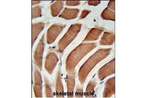 SIKE Antibody (C-term) (ABIN651568 and ABIN2840305) immunohistochemistry analysis in formalin fixed and paraffin embedded human skeletal muscle followed by peroxidase conjugation of the secondary antibody and DAB staining. (SIKE1 anticorps  (C-Term))
