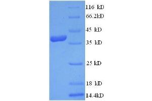 C-Fos Induced Growth Factor (Vascular Endothelial Growth Factor D) (Figf) (AA 89-205), (full length) protein (GST tag)