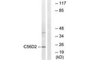Western blot analysis of extracts from Jurkat cells, using C56D2 Antibody. (CYB561D2 anticorps  (AA 55-104))