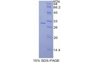 SDS-PAGE analysis of Mouse MAdCAM1 Protein. (MADCAM1 Protéine)
