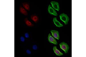 ABIN6262216 and ABIN6269364 staining Hela cells by IF/ICC. (ERBB4 anticorps  (C-Term))