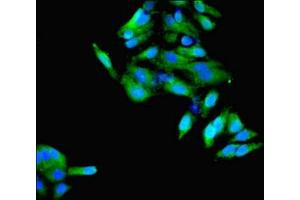 Immunofluorescent analysis of Hela cells using ABIN7148610 at dilution of 1:100 and Alexa Fluor 488-congugated AffiniPure Goat Anti-Rabbit IgG(H+L)