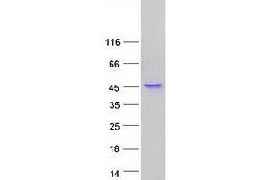 Validation with Western Blot