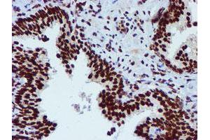 Image no. 12 for anti-Peptidyl Arginine Deiminase, Type IV (PADI4) antibody (ABIN1500017)