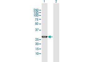 Western Blot analysis of GSTO2 expression in transfected 293T cell line by GSTO2 MaxPab polyclonal antibody.