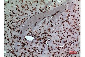 Immunohistochemistry (IHC) analysis of paraffin-embedded Rat Brain, antibody was diluted at 1:100. (Midkine anticorps  (Internal Region))