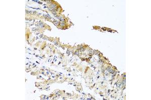 Immunohistochemistry of paraffin-embedded mouse lung using RNASE11 antibody (ABIN5970447) at dilution of 1/100 (40x lens). (RNASE11 anticorps)