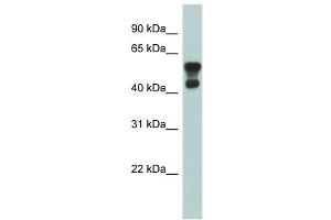 PAFAH1B1 antibody used at 1 ug/ml to detect target protein. (PAFAH1B1 anticorps  (N-Term))
