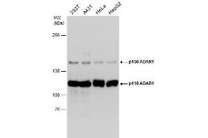 WB Image Various whole cell extracts (30 μg) were separated by 5% SDS-PAGE, and the membrane was blotted with ADAR1 antibody [N3C1], Internal , diluted at 1:1000. (ADAR anticorps)