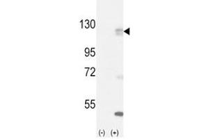 Western blot analysis of FGFR antibody and 293 cell lysate (2 ug/lane) either nontransfected (Lane 1) or transiently transfected with the FGFR1 gene (2). (FGFR1 anticorps  (AA 132-161))