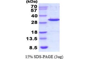 Galectin 3 (LGALS3) (AA 1-264) (Active) protein (His tag)