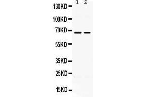 Western blot analysis of ACCN1 expression in rat testis extract ( Lane 1) and MCF-7 whole cell lysates ( Lane 2). (ACCN1 anticorps  (N-Term))