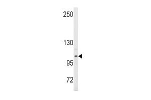Western blot analysis of anti-EN Antibody (Center ) (ABIN389374 and ABIN2839470) in Y79 cell line lysates (35 μg/lane). (ENPP2 anticorps  (AA 401-430))