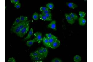 Immunofluorescence staining of HepG2 cells with ABIN7165895 at 1:133, counter-stained with DAPI.