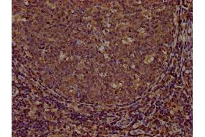 IHC image of ABIN7147160 diluted at 1:100 and staining in paraffin-embedded human tonsil tissue performed on a Leica BondTM system.