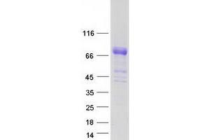 Validation with Western Blot