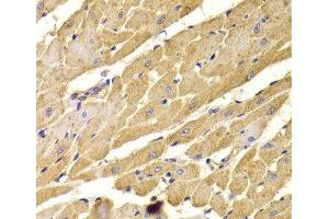 Immunohistochemistry of paraffin-embedded Rat heart using PEX5 Polyclonal Antibody at dilution of 1:100 (40x lens). (PEX5 anticorps)