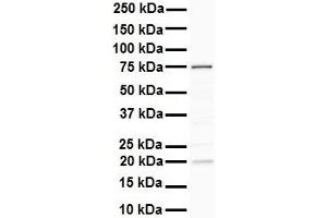 WB Suggested Anti-DDX41 antibody Titration: 1 ug/mL Sample Type: Human liver (DDX41 anticorps  (N-Term))