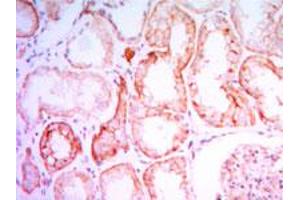 Immunohistochemical analysis of paraffin-embedded human kidney tissue using PTH1R monoclonal antobody, clone 4D2  with DAB staining. (PTH1R anticorps)