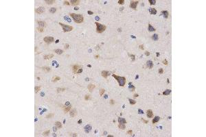 Immunohistochemistry of paraffin-embedded rat brain using KPNA4 Antibody.