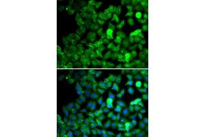 Immunofluorescence analysis of MCF-7 cells using SARS antibody.