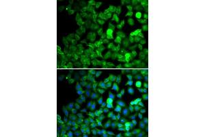 Immunofluorescence analysis of MCF-7 cells using SARS antibody. (Seryl-tRNA Synthetase (SARS) (AA 1-300) anticorps)