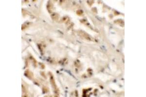 Immunohistochemistry of GZF1 in human kidney tissue with GZF1/ZNF336 Antibody at 2. (ZNF336 anticorps  (C-Term))