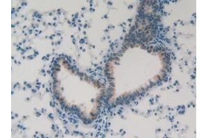 Detection of FOLR4 in Mouse Lung Tissue using Polyclonal Antibody to Folate Receptor 4 (FOLR4) (Folate Receptor 4 anticorps  (AA 56-234))