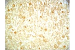 Mouse brain tissue was stained by Rabbit Anti-Metasin (1-25) (Human) / KISS-1 (68-92) (Human) Serum (KISS1 anticorps  (AA 1-25, AA 68-92))