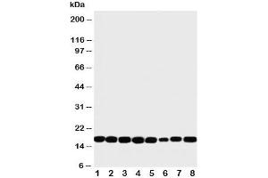 Western blot testing of NM23 antibody and rat samples 1: heart;  2: brain;  3: liver;  4: skeletal muscle; and human samples 5: PANC;  6: HeLa;  7: SKOV;  8: COLO320 cell lysate (NME1 anticorps  (C-Term))